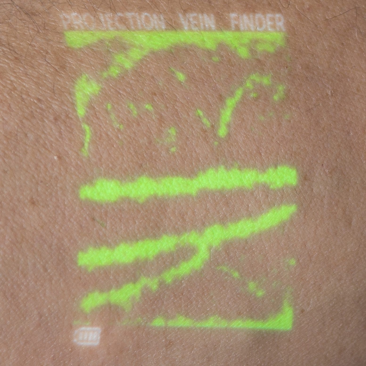 NextVein V800NV Augmented Reality Vein Projection – Green Veins, Dark Background NextVein V800NV Augmented Reality Vein Projection – Green Veins, Dark Background